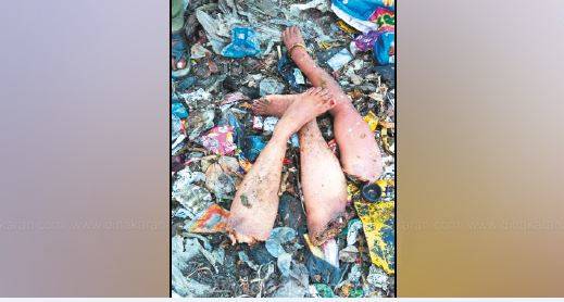 Photo of குப்பை கிடங்கில் கண்டெடுக்கப்பட்ட பெண்ணின் கை, கால்கள் – ஆய்வு செய்யும் மருத்துவ குழு